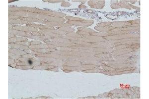 Immunohistochemical analysis of paraffin-embedded Mouse Skeletal MuscleTissue using IGFN1 Polyclonal Antibody. (IGFN1 抗体)