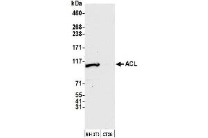 Western Blotting (WB) image for anti-ATP Citrate Lyase (ACLY) (AA 350-400) antibody (ABIN7449939)