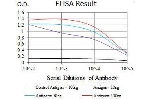 Black line: Control Antigen (100 ng), Purple line: Antigen(10 ng), Blue line: Antigen (50 ng), Red line: Antigen (100 ng), (DNAL4 抗体  (AA 1-105))