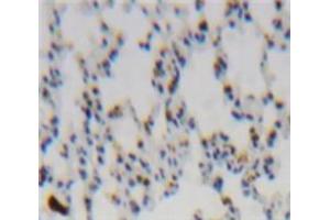 Used in DAB staining on fromalin fixed paraffin-embedded Lung tissue (CCL2 抗体  (AA 1-99))