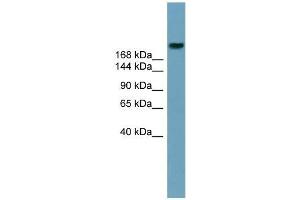 Human Stomach; WB Suggested Anti-ABCA12 Antibody Titration: 0. (ABCA12 抗体  (Middle Region))
