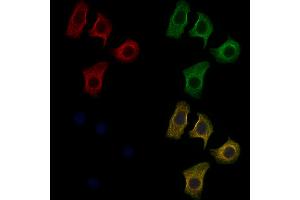 ABIN6259561 and ABIN6274852 staining Hela cells by IF/ICC. (C1orf135 抗体  (Internal Region))