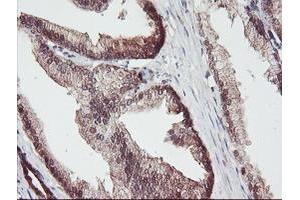 Image no. 12 for anti-Aminoacylase 1 (ACY1) antibody (ABIN1496455)