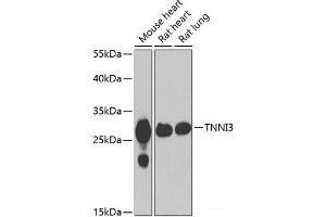 Western blot analysis of extracts of various cell lines using TNNI3 Polyclonal Antibody at dilution of 1:1000. (TNNI3 抗体)