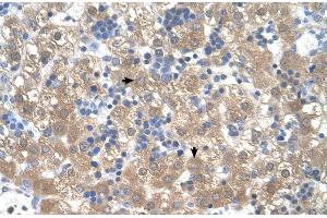 Human Liver (PEX3 抗体  (N-Term))