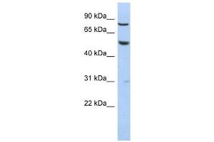 GPR56 antibody used at 1 ug/ml to detect target protein. (GPR56 抗体  (N-Term))