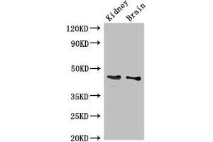 Western Blot Positive WB detected in: Mouse kidney tissue, Mouse brain tissue All lanes: GDF11 antibody at 3 μg/mL Secondary Goat polyclonal to rabbit IgG at 1/50000 dilution Predicted band size: 46 kDa Observed band size: 46 kDa (GDF11 抗体  (AA 296-404))