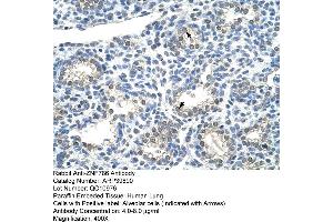 Human Lung (ZNF786 抗体  (N-Term))
