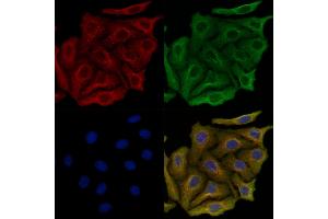 ABIN6264024 and ABIN6279643 staining Hela cells by IF/ICC.