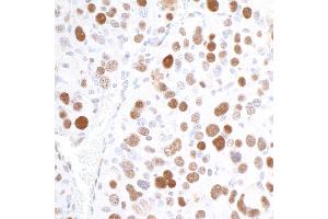 Immunohistochemistry (IHC) image for anti-Importin Subunit alpha-1 (KPNA2) (C-Term) antibody (ABIN7453571) (Importin Subunit alpha-1 (KPNA2) (C-Term) 抗体)