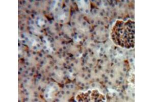 Used in DAB staining on fromalin fixed paraffin-embedded Kidney tissue (Hexosaminidase A 抗体  (AA 318-529))