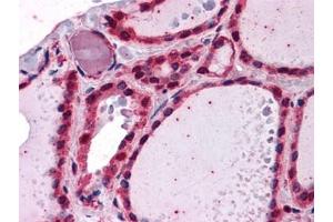 Immunohistochemistry (IHC) image for anti-Interleukin-1 Receptor-Associated Kinase 1 (IRAK1) (AA 530-693) antibody (ABIN614625) (IRAK1 抗体  (AA 530-693))