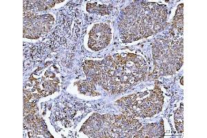IHC analysis of GLUD1/2 using anti-GLUD1/2 antibody (ABIN7602000). (GLUD1 / GLUD2 (AA 54-553) 抗体)