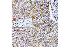 Immunohistochemistry (IHC) image for anti-Catenin (Cadherin-Associated Protein), beta 1, 88kDa (CTNNB1) antibody (ABIN7266137)