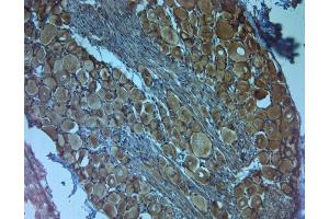 Immunohistochemistry (IHC) image for anti-Neurotrophic tyrosine Kinase, Receptor, Type 3 (NTRK3) antibody (ABIN351087)