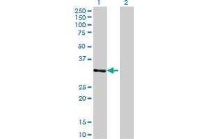 Western Blotting (WB) image for anti-Zinc Finger Protein 397 (ZNF397) (AA 131-231) antibody (ABIN599599) (ZNF397 抗体  (AA 131-231))