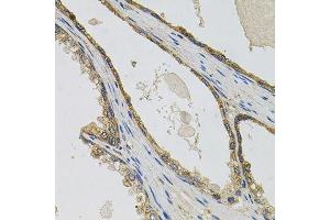 Immunohistochemistry of paraffin-embedded human prostate using PTK7 antibody. (PTK7 抗体  (AA 811-1070))