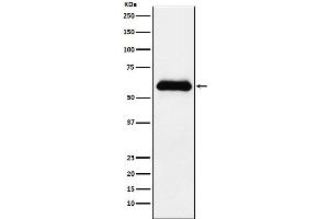 Western blot analysis of alpha 1 Antichymotrypsin expression in human plasma lysate.