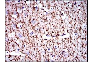 Immunohistochemical analysis of paraffin-embedded brain tissues using MBP mouse mAb with DAB staining. (MBP 抗体)