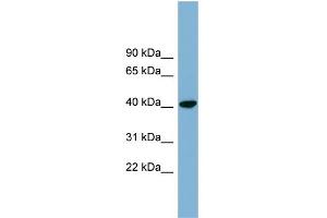WB Suggested Anti-PINX1 Antibody Titration: 0. (PINX1 抗体  (N-Term))