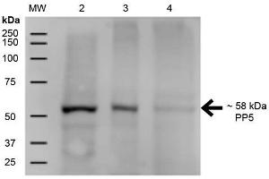 Western Blot analysis of Human A431, HEK293, and Jurkat cell lysates showing detection of ~58 kDa PP5 protein using Mouse Anti-PP5 Monoclonal Antibody, Clone 12F7 . (PP5 抗体  (APC))