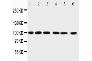 Image no. 1 for anti-Protein Inhibitor of Activated STAT, 1 (PIAS1) (AA 636-651) antibody (ABIN3032369) (PIAS1 抗体  (AA 636-651))