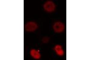 ABIN6274512 staining NIH-3T3 cells by IF/ICC. (ZSCAN16 抗体)