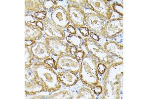 Immunohistochemistry of paraffin-embedded rat kidney using MT-CO3 antibody (ABIN7266636) at dilution of 1:100 (40x lens). (COX3 抗体)