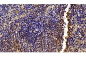 Detection of LXRb in Mouse Spleen Tissue using Polyclonal Antibody to Liver X Receptor Beta (LXRb) (NR1H2 抗体  (AA 1-446))