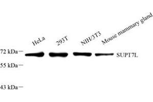 Western blot analysis of SUPT7L (ABIN7075768) at dilution of 1: 2000 (SUPT7L 抗体)