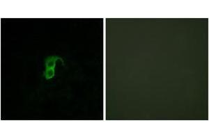 Immunofluorescence analysis of HuvEc cells, using GPR87 Antibody. (GPR87 抗体  (AA 221-270))