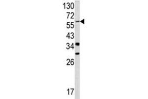 Western blot analysis of YAP antibody and NCI-H460 lysate. (YAP1 抗体  (AA 420-446))