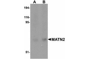 Image no. 1 for anti-Matrilin 2 (MATN2) (C-Term) antibody (ABIN478061) (MATN2 抗体  (C-Term))