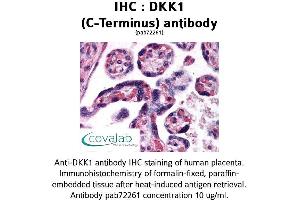 Image no. 1 for anti-Dickkopf Homolog 1 (DKK1) (C-Term) antibody (ABIN1733668) (DKK1 抗体  (C-Term))