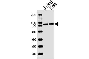 Lane 1: Jurkat Cell lysates, Lane 2: HeLa Cell lysates, probed with USP11 (1220CT620. (USP11 抗体)
