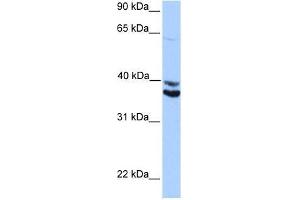 MDFIC antibody used at 0. (MDFIC 抗体  (Middle Region))