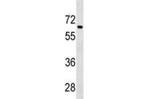 Western Blotting (WB) image for anti-Transforming Growth Factor, beta Receptor II (70/80kDa) (TGFBR2) (AA 548-575) antibody (ABIN3029225)