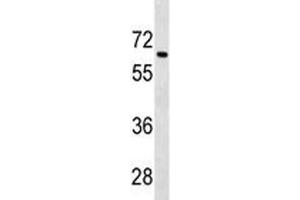 Tgfbr2 antibody western blot analysis in 293 lysate. (TGFBR2 抗体  (AA 548-575))