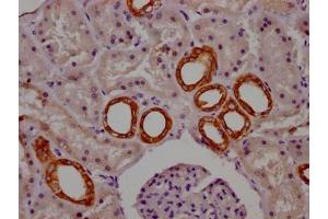 Immunohistochemistry (IHC) image for anti-Cytochrome P450, Family 1, Subfamily A, Polypeptide 2 (CYP1A2) antibody (ABIN7127447)