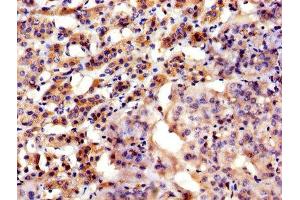 IHC image of ABIN7144757 diluted at 1:300 and staining in paraffin-embedded human adrenal gland tissue performed on a Leica BondTM system. (Aspartate beta Hydroxylase 抗体  (AA 75-270))