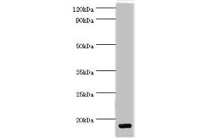 Western blot All lanes: C-C motif chemokine 28 antibody at 5 μg/mL + Mouse spleen tissue Secondary Goat polyclonal to rabbit IgG at 1/10000 dilution Predicted band size: 15, 13 kDa Observed band size: 15 kDa (CCL28 抗体  (AA 20-127))