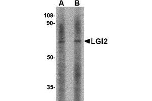 Western Blotting (WB) image for anti-Leucine-Rich Repeat LGI Family, Member 2 (LGI2) (Middle Region) antibody (ABIN1030982)