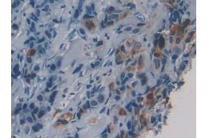 #VALUE! (HSD17B1 抗体  (AA 4-289))