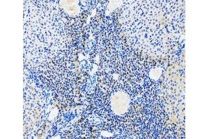 Immunohistochemistry of paraffin-embedded Rat ovary using Myogenin Polyclonal Antibody at dilution of 1:100 (20x lens). (Myogenin 抗体)