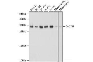Western blot analysis of extracts of various cell lines using CACYBP Polyclonal Antibody at dilution of 1:1000. (CACYBP 抗体)