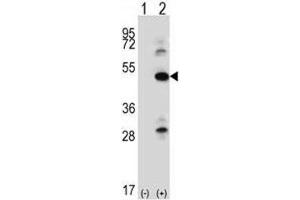 Western blot analysis of ILK antibody and 293 cell lysate either nontransfected (Lane 1) or transiently transfected (2) with the ILK gene. (ILK 抗体  (AA 225-253))