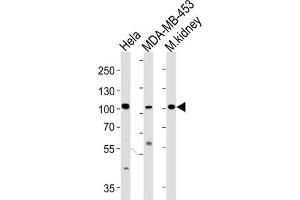 Western Blotting (WB) image for anti-Nuclear Receptor Coactivator 7 (NCOA7) antibody (ABIN3004220) (NCOA7 抗体)