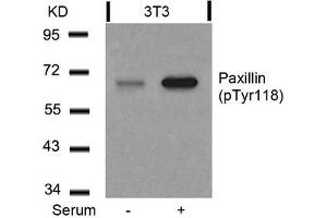 Western blot analysis of extracts from 3T3 cells untreated or treated with serum using Paxillin(Phospho-Tyr118) Antibody.