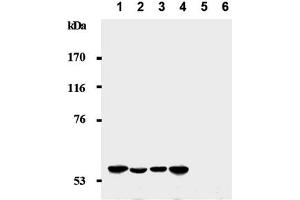 Western Blotting (WB) image for anti-Cyclin-Dependent Kinase Inhibitor 1C (p57, Kip2) (CDKN1C) antibody (ABIN487486) (CDKN1C 抗体)