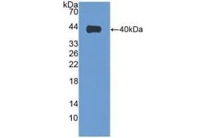 Detection of Recombinant VIL1, Human using Polyclonal Antibody to Villin (VIL) (Villin 1 抗体  (AA 1-320))